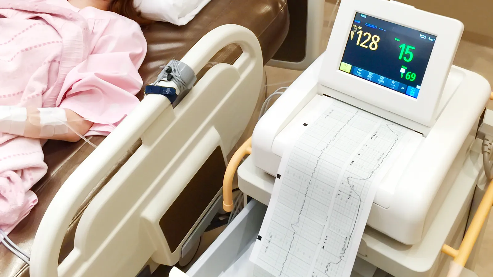 nst モニター 見方